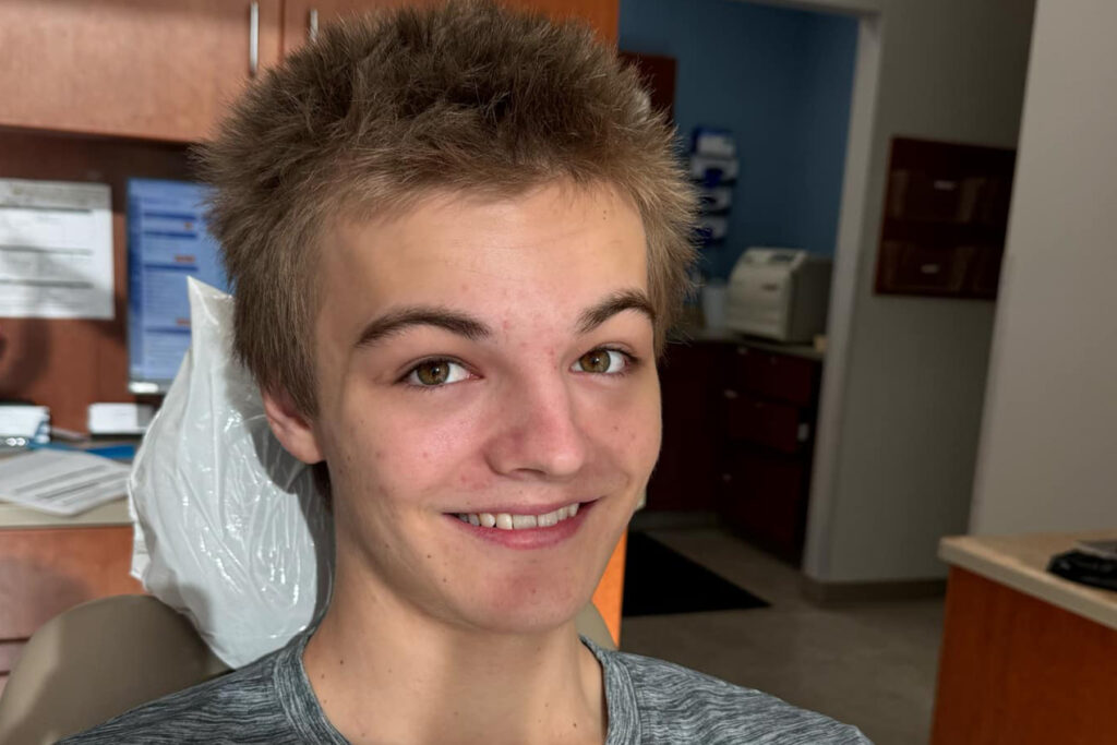 Close up of Carson Tucker smiling after partial denture treatment.